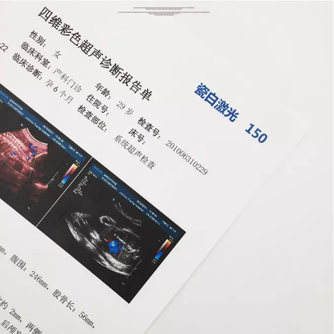 Not Picky Printers, Ordinary General Laser Printer Double-Sided White Coating PET Film
